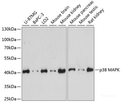 Western blot analysis of extracts of various cell lines using B4GALT4 Polyclonal Antibody at dilution of 1:1000.