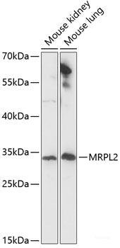 Immunohistochemistry of paraffin-embedded Rat heart using ABCB7 Polyclonal Antibody at dilution of 1:100 (40x lens).
