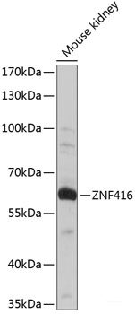 Western blot analysis of extracts of various cell lines using ATP6V1A Polyclonal Antibody at dilution of 1:1000.