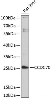 Western blot analysis of extracts of various cell lines using ADRA1A Polyclonal Antibody at dilution of 1:1000.