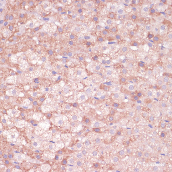Immunofluorescence analysis of HeLa cells using CALM1 Polyclonal Antibody at dilution of 1:100 (40x lens). Blue: DAPI for nuclear staining.