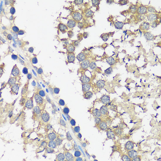 Immunofluorescence analysis of NIH-3T3 cells using CSNK2B Polyclonal Antibody at dilution of 1:100 (40x lens). Blue: DAPI for nuclear staining.