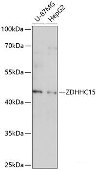 Western blot analysis of extracts of U-251MG cells using GPR6 Polyclonal Antibody at dilution of 1:1000.