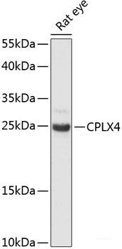 Western blot analysis of extracts of various cell lines using KRT12 Polyclonal Antibody at dilution of 1:1000.
