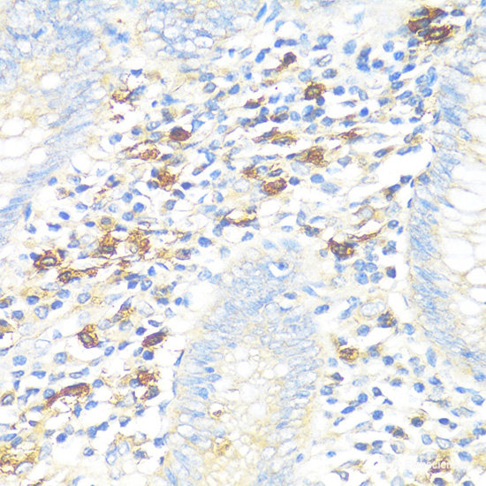 Immunohistochemistry of paraffin-embedded Rat ovary using ALDH6A1 Polyclonal Antibody at dilution of 1:100 (40x lens).