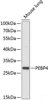 Immunohistochemistry of paraffin-embedded Human stomach using PAEP Polyclonal Antibody at dilution of 1:100 (40x lens).