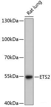 Immunohistochemistry of paraffin-embedded Human colon using SERPINE1 Polyclonal Antibody at dilution of 1:100 (40x lens).