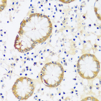 Immunofluorescence analysis of U2OS cells using PFKFB3 Polyclonal Antibody