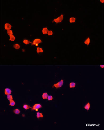 Western blot analysis of extracts of HeLa cells using MAP2K2 Polyclonal Antibody at dilution of 1:1000.