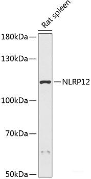 Immunofluorescence analysis of L929 cells using RPE Polyclonal Antibody at dilution of 1:100 (40x lens). Blue: DAPI for nuclear staining.