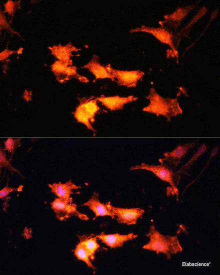 Western blot analysis of extracts of various cell lines using S100P Polyclonal Antibody at dilution of 1:1000.