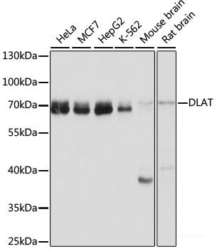 Immunofluorescence analysis of U2OS cells using XBP1 Polyclonal Antibody at dilution of 1:100. Blue: DAPI for nuclear staining.