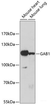 Immunohistochemistry of paraffin-embedded Mouse lung using ZNF141 Polyclonal Antibody at dilution of 1:100 (40x lens).