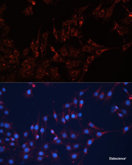 Immunohistochemistry of paraffin-embedded Human liver using SLC5A6 Polyclonal Antibody at dilution of 1:100 (40x lens).
