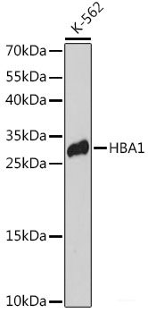Immunohistochemistry of paraffin-embedded Mouse testis using DDX21 Polyclonal Antibody at dilution of 1:100 (40x lens).