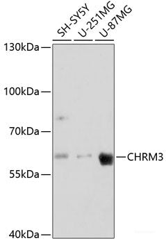 Western blot analysis of extracts of various cell lines using p21 Polyclonal Antibody at dilution of 1:1000.