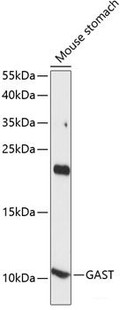 Immunohistochemistry of paraffin-embedded Human appendix using ERLIN1 Polyclonal Antibody at dilution of 1:100 (40x lens).