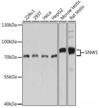 Immunohistochemistry of paraffin-embedded Rat testis using PSIP1 Polyclonal Antibody at dilution of 1:100 (40x lens).