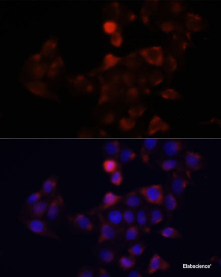 Western blot analysis of extracts of Mouse brain using LGALSL Polyclonal Antibody at dilution of 1:1000.