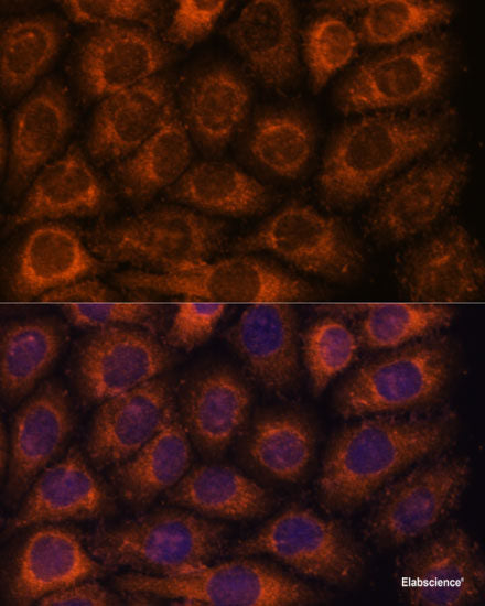 Western blot analysis of extracts of Mouse liver using TLR8 Polyclonal Antibody at dilution of 1:1000.