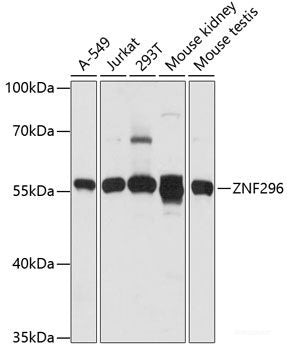 Immunohistochemistry of paraffin-embedded Rat liver using ZNF446 Polyclonal Antibody at dilution of 1:100 (40x lens).