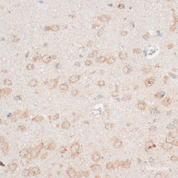 Immunofluorescence analysis of Rat testis using OXCT2 Polyclonal Antibody at dilution of 1:100. Blue: DAPI for nuclear staining.