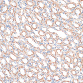 Immunofluorescence analysis of L929 cells using NTPCR Polyclonal Antibody at dilution of 1:100. Blue: DAPI for nuclear staining.
