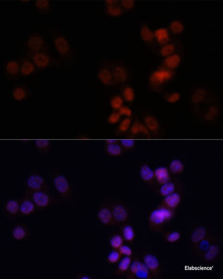 Immunohistochemistry of paraffin-embedded Rat brain using Osteopontin Polyclonal Antibody at dilution of 1:100 (40x lens).