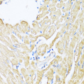 Immunofluorescence analysis of NIH/3T3 cells using YTHDC2 Polyclonal Antibody at dilution of 1:100. Blue: DAPI for nuclear staining.
