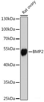 Western blot analysis of extracts of A-549 cells using SGMS1 Polyclonal Antibody at dilution of 1:1000.