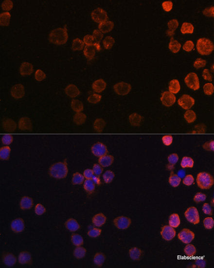 Immunohistochemistry of paraffin-embedded Rat spleen using AARS Polyclonal Antibody at dilution of 1:100 (40x lens).