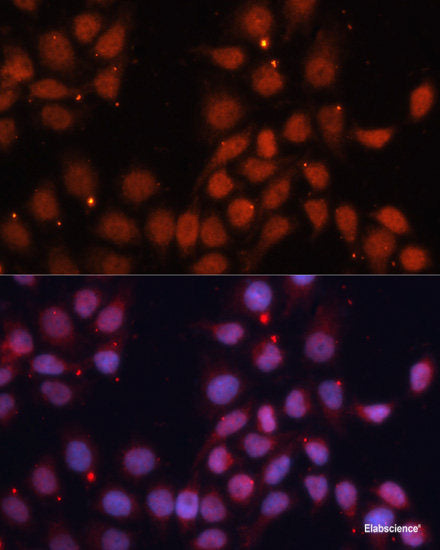 Immunofluorescence analysis of HeLa cells using ACAA1 Polyclonal Antibody at dilution of 1:100 (40x lens). Blue: DAPI for nuclear staining.