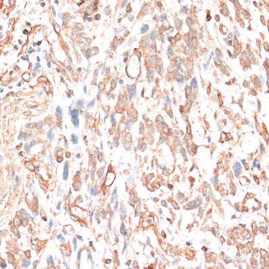 Immunohistochemistry of paraffin-embedded Rat brain using ACADSB Polyclonal Antibody at dilution of 1:100 (40x lens).
