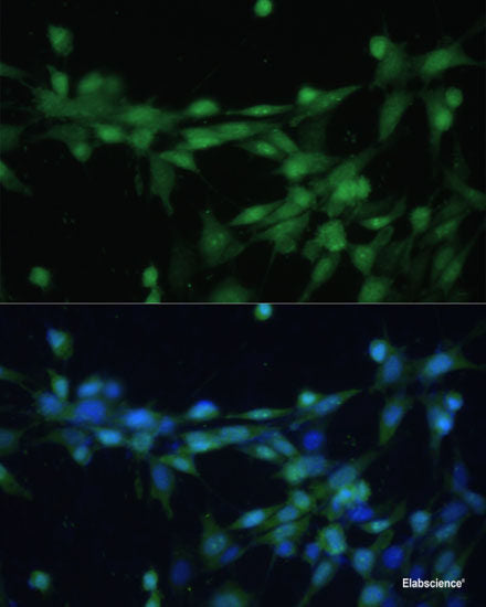 Immunofluorescence analysis of HeLa cells using ACP1 Polyclonal Antibody at dilution of 1:100 (40x lens). Blue: DAPI for nuclear staining.