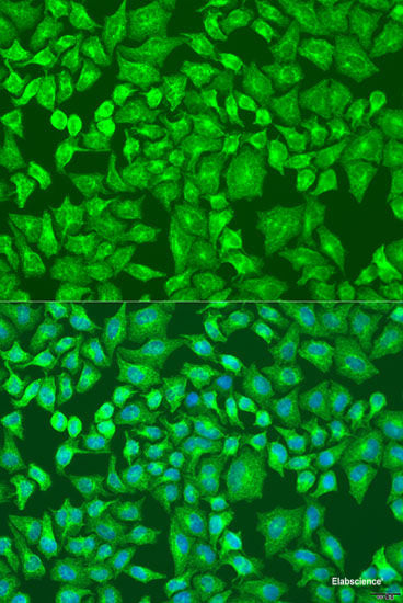 Immunofluorescence analysis of HeLa cells using ACYP1 Polyclonal Antibody at dilution of 1:100 (40x lens). Blue: DAPI for nuclear staining.