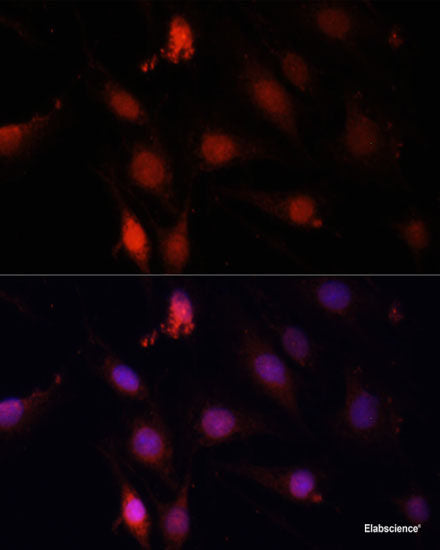 Immunofluorescence analysis of HeLa cells using ADAM8 Polyclonal Antibody at dilution of 1:100 (40x lens). Blue: DAPI for nuclear staining.