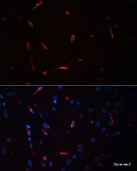 Immunofluorescence analysis of U2OS cells using ALDH1B1 Polyclonal Antibody at dilution of 1:100. Blue: DAPI for nuclear staining.