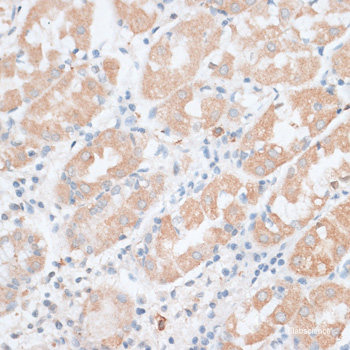 Immunofluorescence analysis of U2OS cells using CHD1 Polyclonal Antibody at dilution of 1:100. Blue: DAPI for nuclear staining.