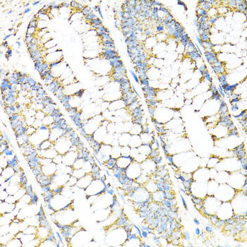 Western blot analysis of extracts of Mouse pancreas using FOXN3 Polyclonal Antibody at dilution of 1:1000.