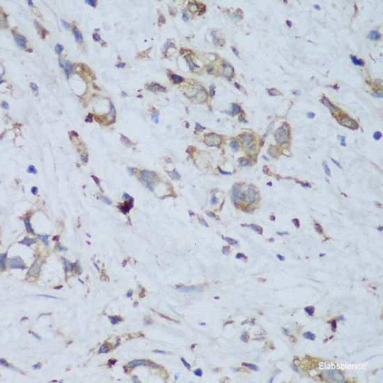 Western blot analysis of extracts of Mouse thymus using LTB4R Polyclonal Antibody at dilution of 1:1000.