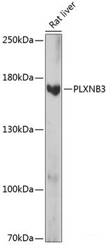 Immunofluorescence analysis of HeLa cells using CYP2A6 Polyclonal Antibody at dilution of 1:100 (40x lens). Blue: DAPI for nuclear staining.