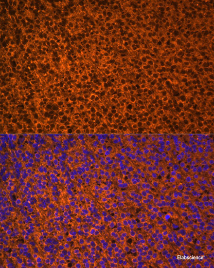 Immunohistochemistry of paraffin-embedded Rat kidney using DAPK3 Polyclonal Antibody at dilution of 1:100 (40x lens).