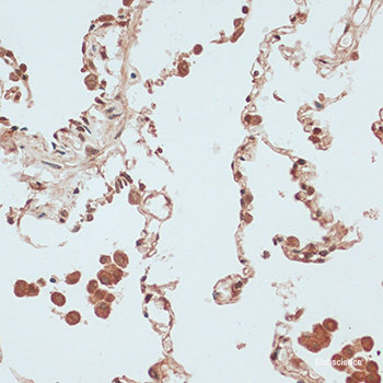 Western blot analysis of extracts of Mouse kidney using EGR2 Polyclonal Antibody at dilution of 1:1000.
