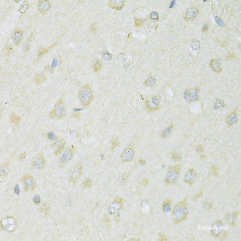 Immunofluorescence analysis of U2OS cells using GYPB Polyclonal Antibody at dilution of 1:100. Blue: DAPI for nuclear staining.