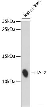 Immunofluorescence analysis of U2OS cells using IFNW1 Polyclonal Antibody at dilution of 1:100. Blue: DAPI for nuclear staining.
