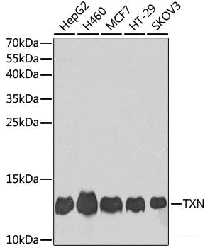 Western blot analysis of extracts of various cell lines using KRT14 Polyclonal Antibody at dilution of 1:1000.