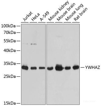 Immunofluorescence analysis of U2OS cells using LRP6 Polyclonal Antibody at dilution of 1:100. Blue: DAPI for nuclear staining.