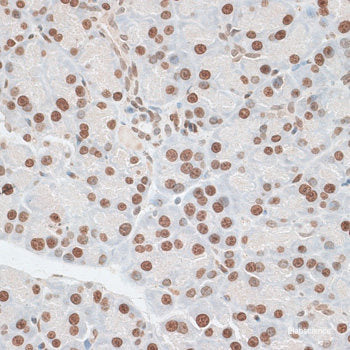 Immunofluorescence analysis of HUVEC cells using eNOS Polyclonal Antibody at dilution of 1:100 (40x lens). Blue: DAPI for nuclear staining.