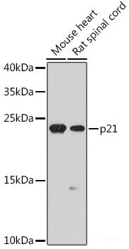 Immunofluorescence analysis of L929 cells using RPL28 Polyclonal Antibody at dilution of 1:100. Blue: DAPI for nuclear staining.