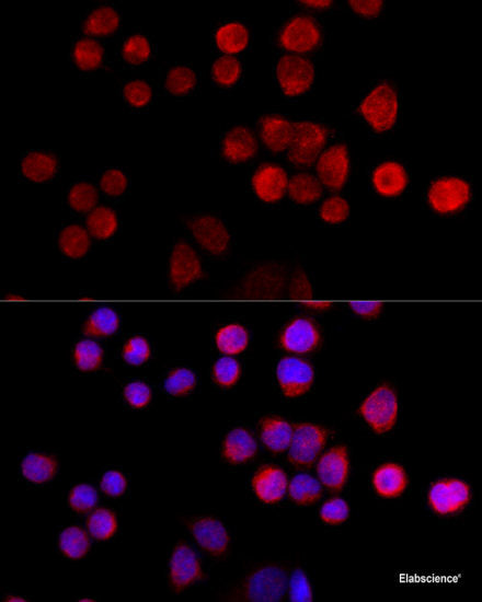 Immunofluorescence analysis of C6 cells using SSTR2 Polyclonal Antibody at dilution of 1:100 (40x lens). Blue: DAPI for nuclear staining.